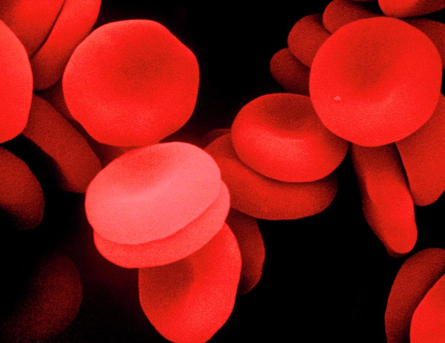 False-colour Sem Of Human Red Blood Cells #4 Photograph by Dr Tony Brain/science Photo Library
