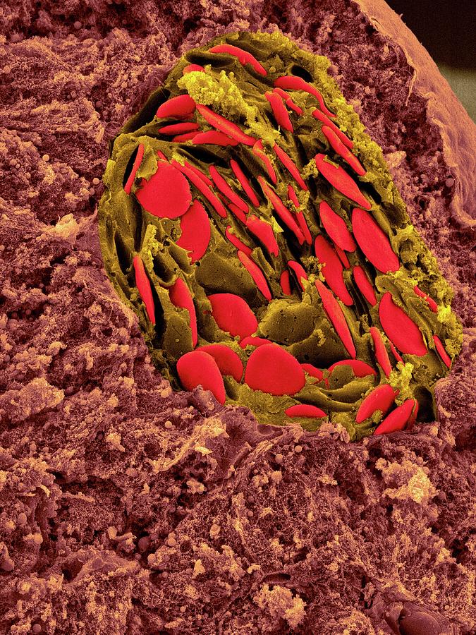 Frog Blood In Liver Blood Vessel #4 Photograph by Dennis Kunkel Microscopy/science Photo Library