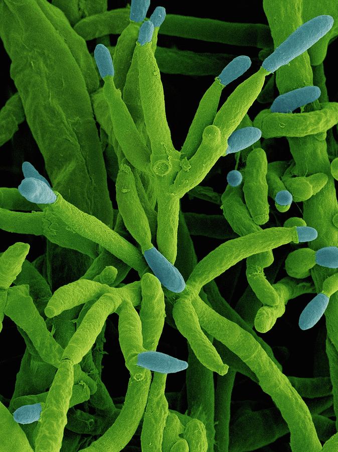 Fusarium Incarnatum Pathogenic Fungus #4 Photograph by Dennis Kunkel Microscopy/science Photo Library