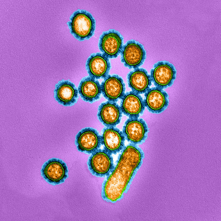 H1n1, Influenza A Virus, Swine Flu, Tem #4 Photograph by Science Source