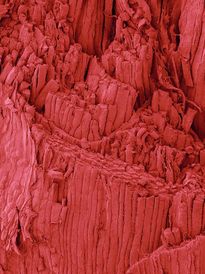 Ham Shank Muscle Fibres #4 Photograph by Dennis Kunkel Microscopy/science Photo Library