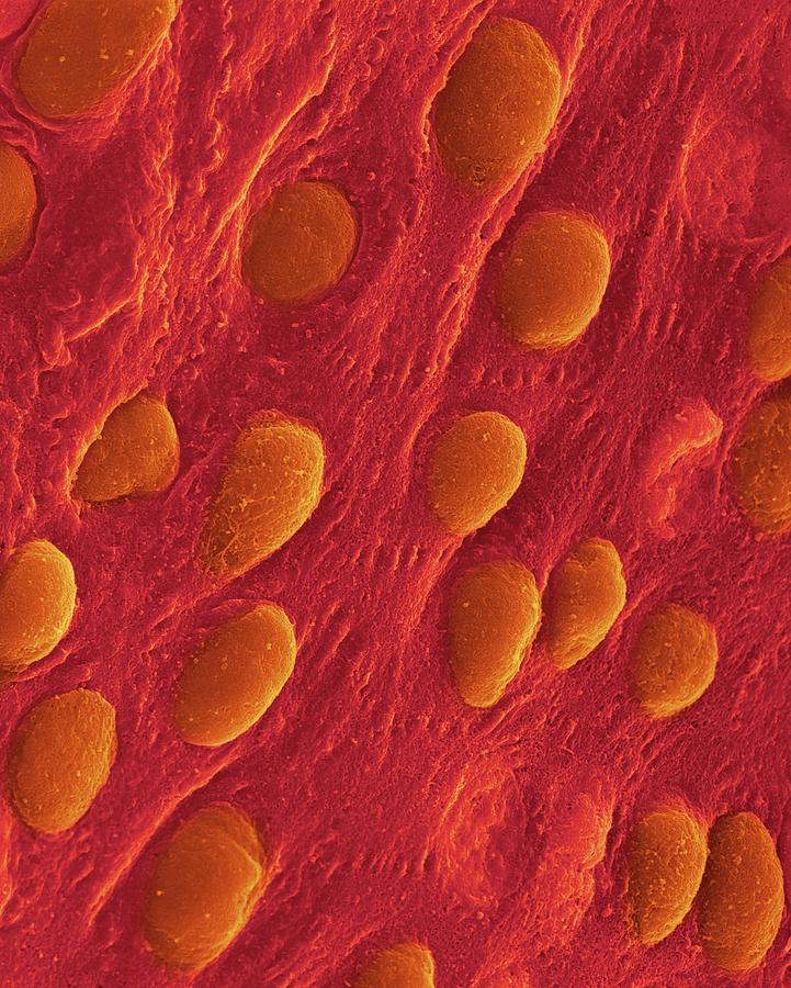 Heart Pericardium Surface #4 Photograph by Dennis Kunkel Microscopy/science Photo Library
