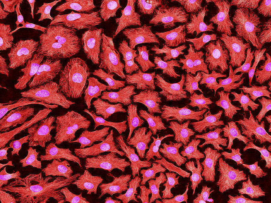 Hela Cells, Mfm #4 Photograph by Science Source
