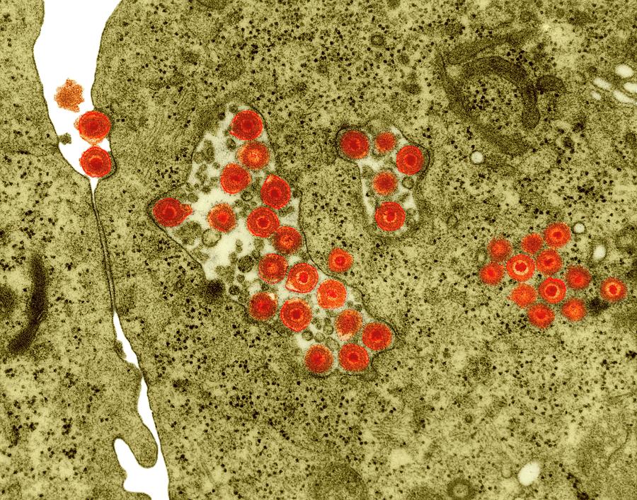 Herpes Simplex Virus #4 Photograph by Dennis Kunkel Microscopy/science Photo Library
