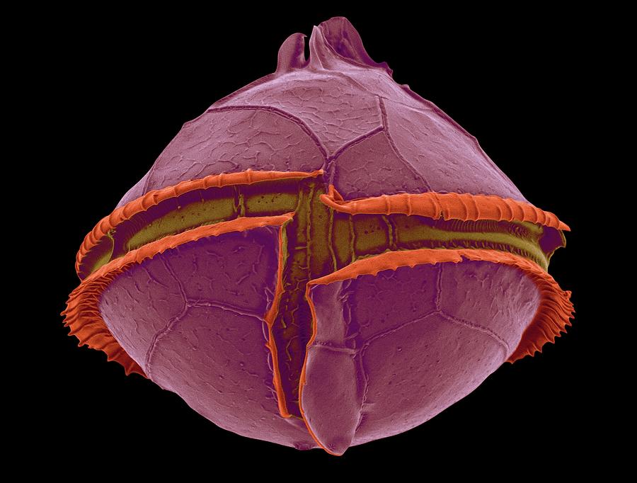 Heterotrophic Dinoflagellate (oblea Sp.) Photograph by Dennis Kunkel ...