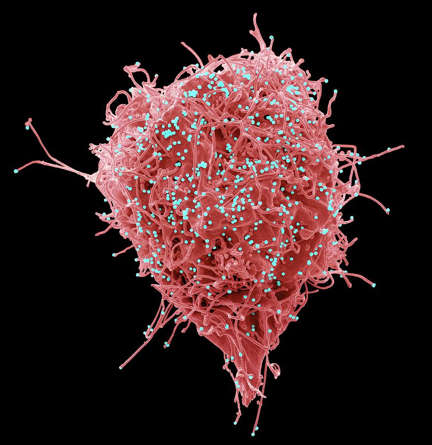 Hiv Infected Cell Photograph by Steve Gschmeissner/science Photo ...