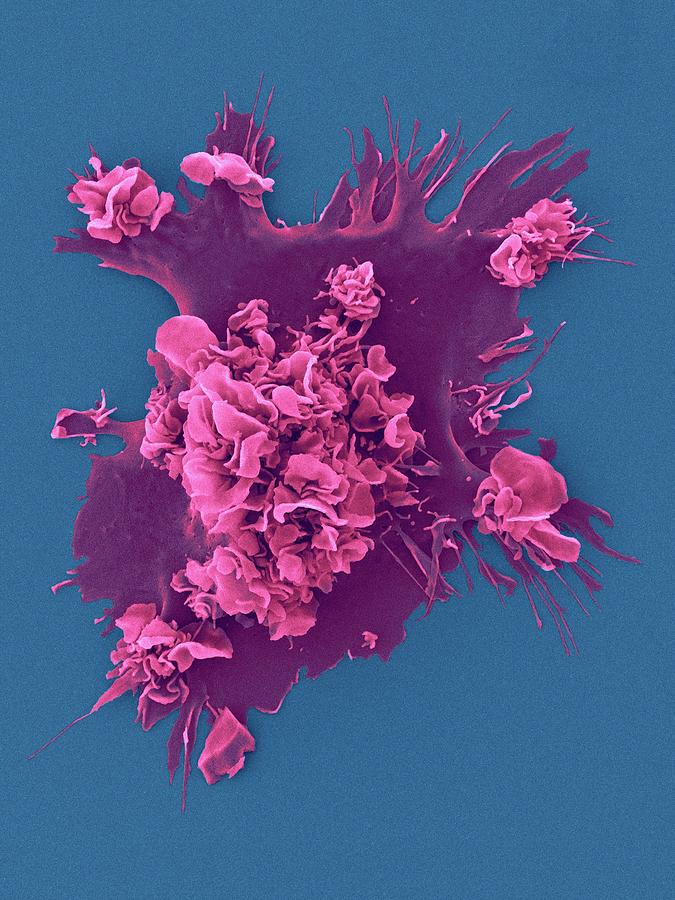 Human Dendritic Cell Photograph by Dennis Kunkel Microscopy/science ...