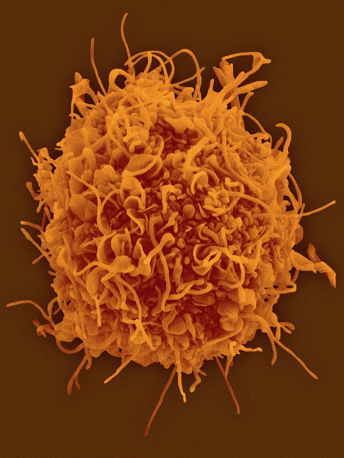 Human Dendritic Cells Photograph by Dennis Kunkel Microscopy/science ...