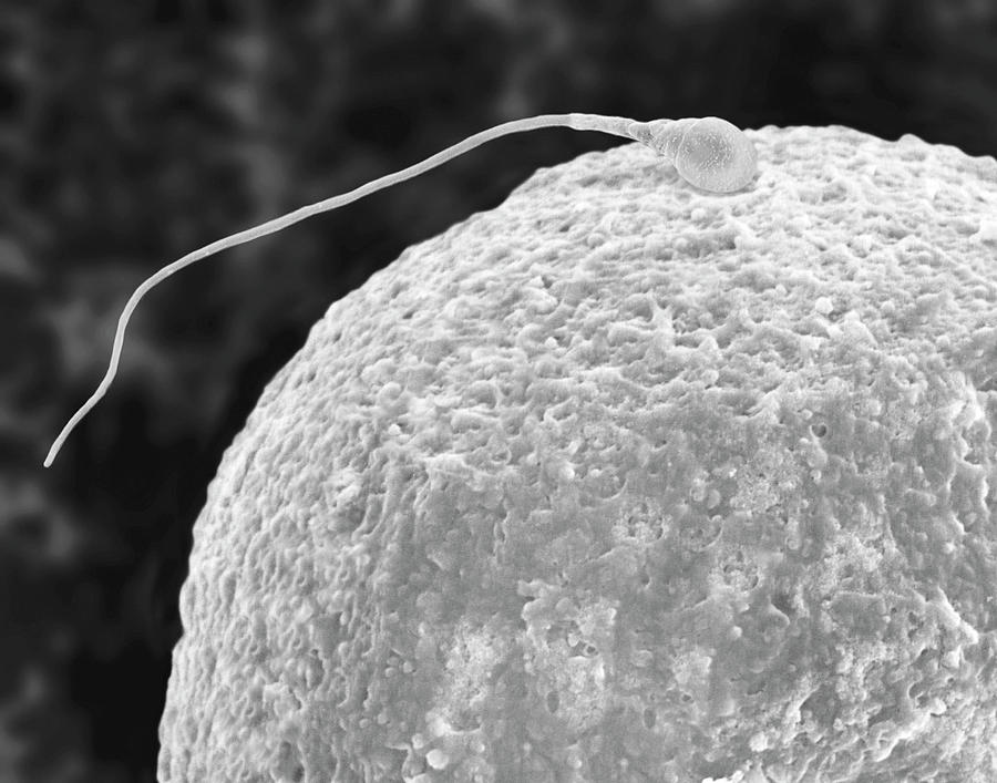 Human Egg Cell And Sperm