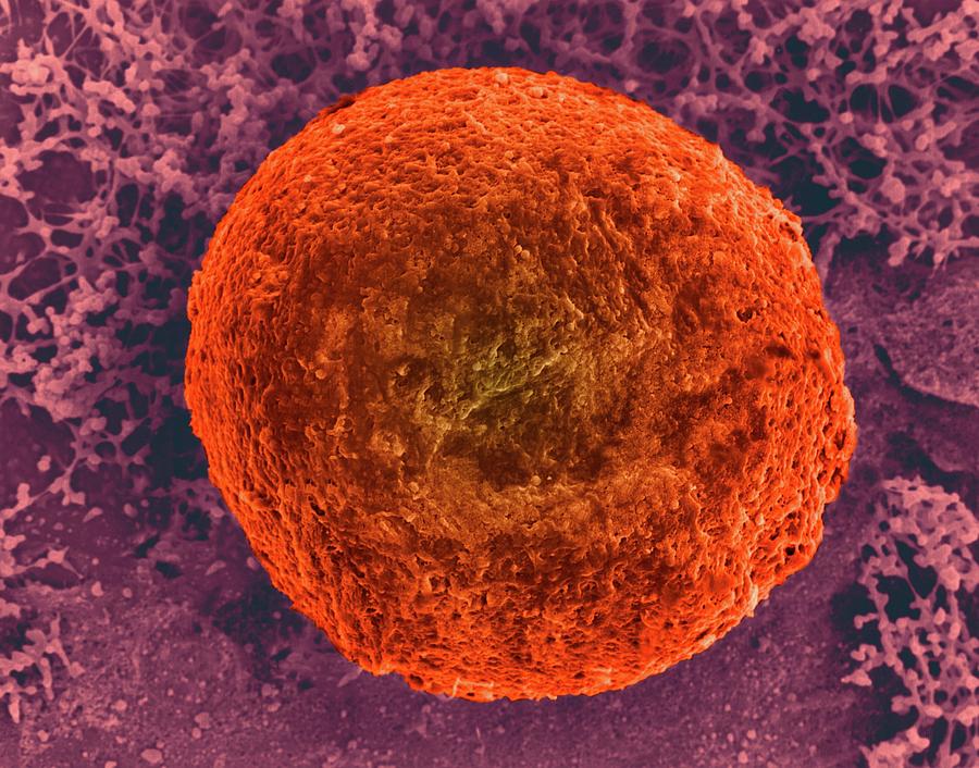 Human Egg Cell Visible