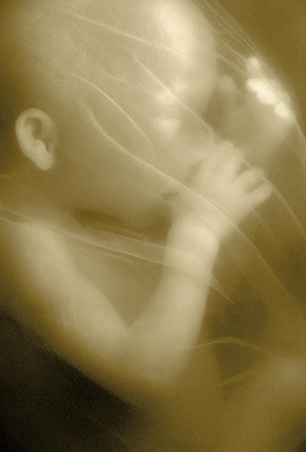 19 Weeks Photograph - Human foetus in the womb #4 by Science Photo Library