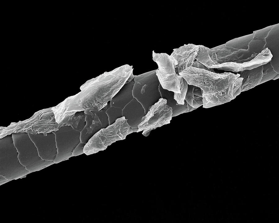 human hair under electron microscope