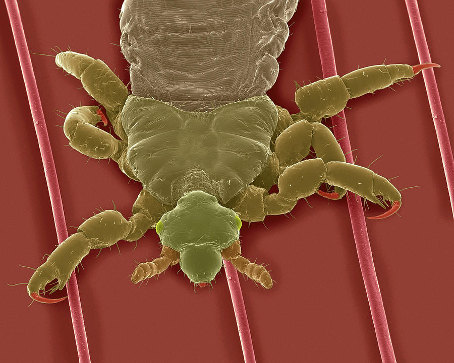 human louse hair