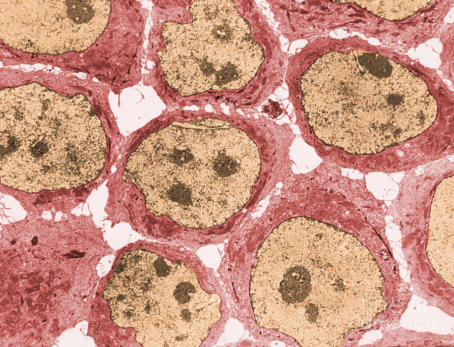 Human Kb Cells Tem #4 Photograph by David M. Phillips