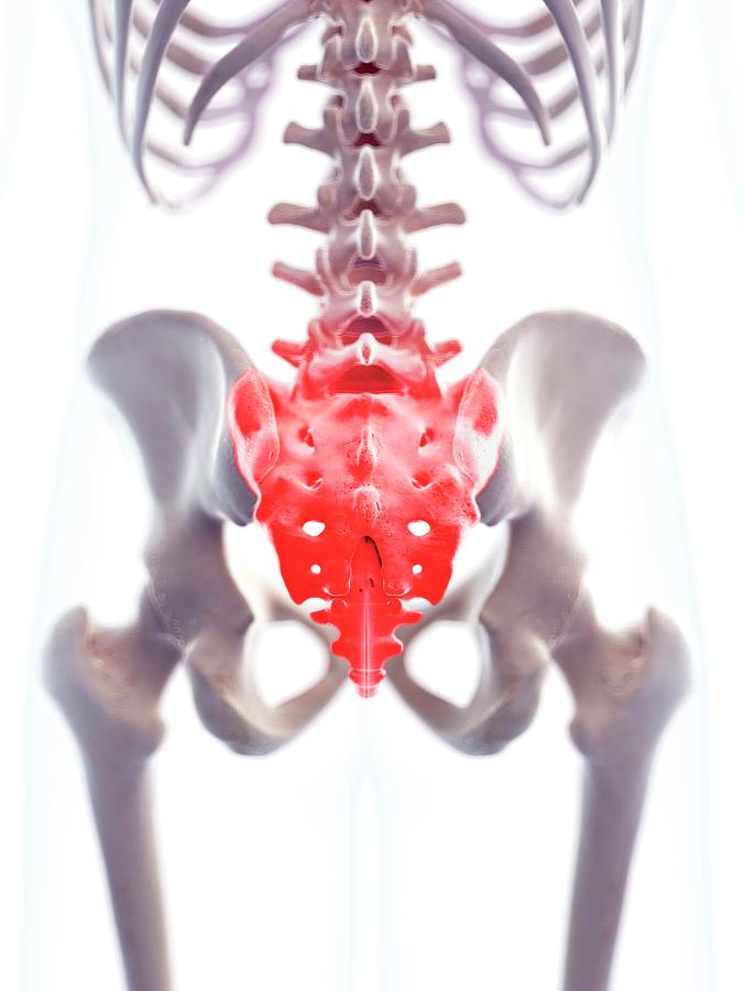 Human Sacrum Pain Photograph by Sebastian Kaulitzki/science Photo ...