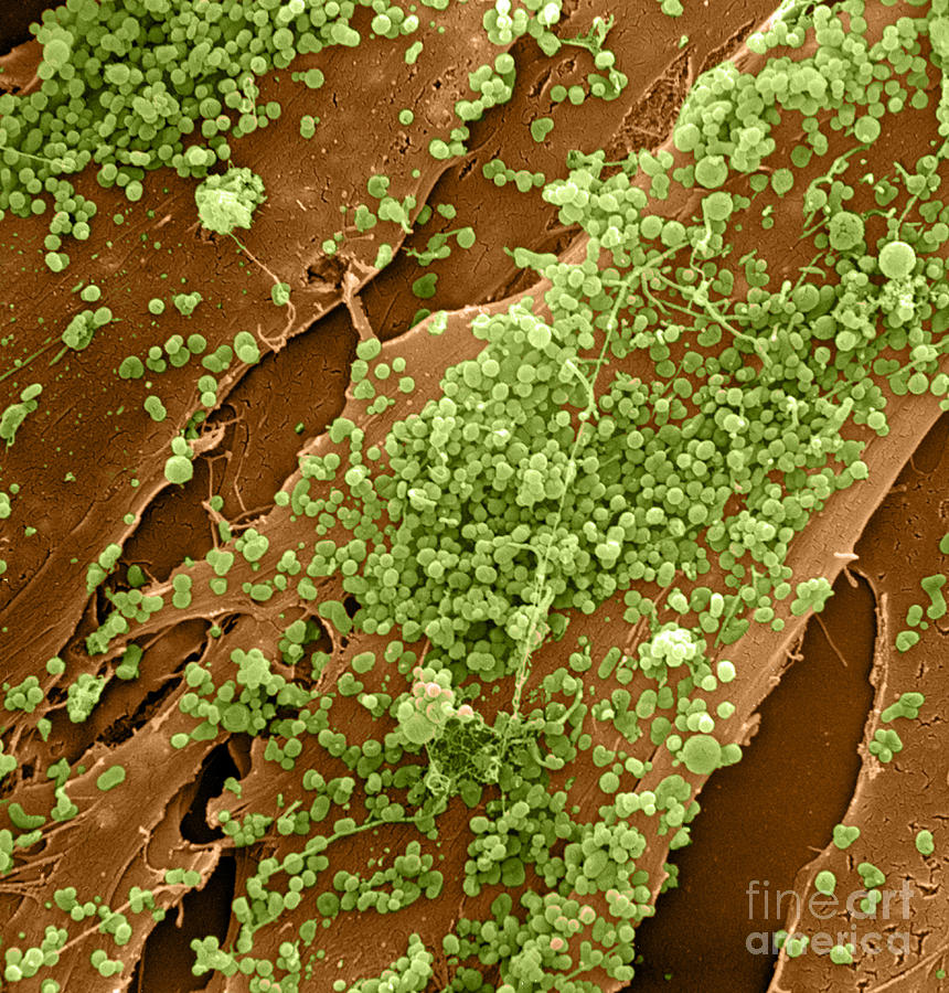 Human Skin Cell Sem #4 Photograph by David M. Phillips