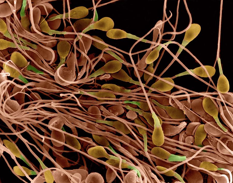 microscope view of sperm