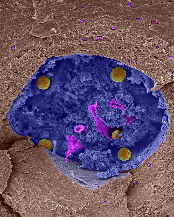 Human Stem Cells In Bone Marrow Cavity #4 Photograph by Dennis Kunkel Microscopy/science Photo Library