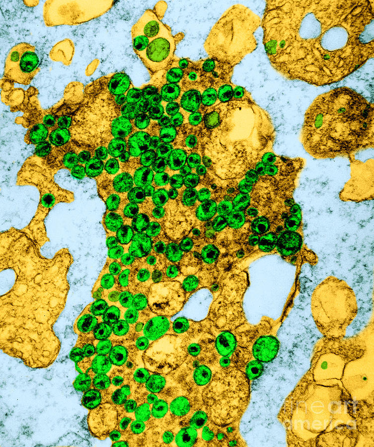 Human T-lymphocyte Showing Hiv #4 Photograph by Kwangshin Kim