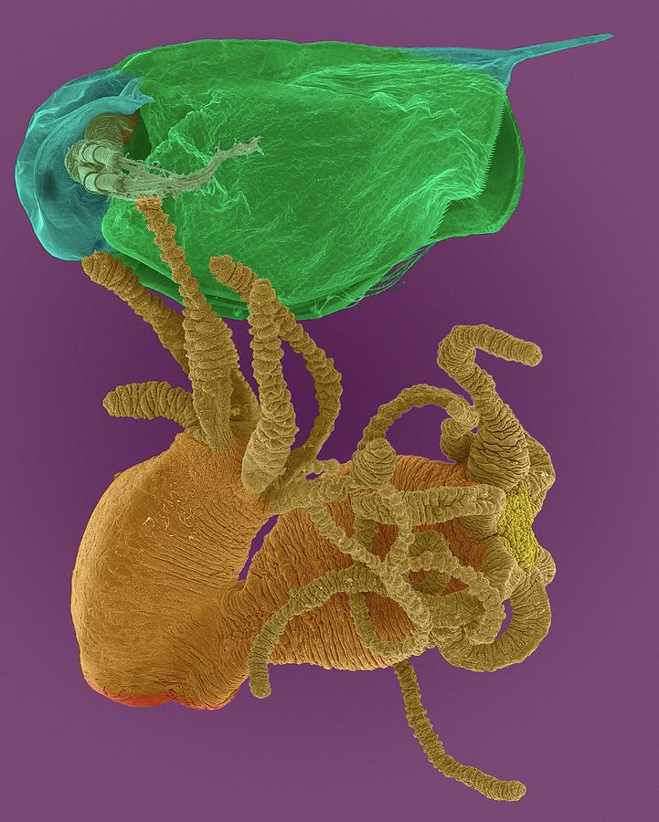 Invertebrate Photograph - Hydra Sp. Capturing Daphnia Sp. #4 by Dennis Kunkel Microscopy/science Photo Library