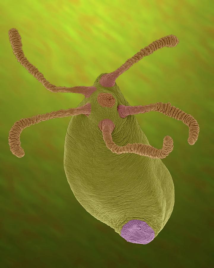 Hydra Sp. (cnidarian) #4 Photograph by Dennis Kunkel Microscopy/science Photo Library