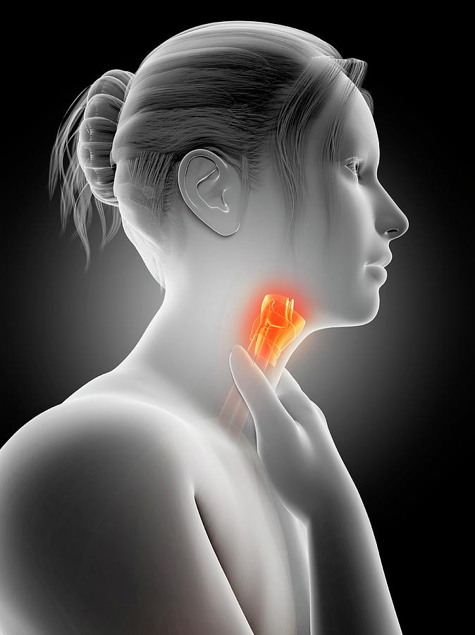 Illustration Photograph - Inflammation Of The Larynx #4 by Sebastian Kaulitzki