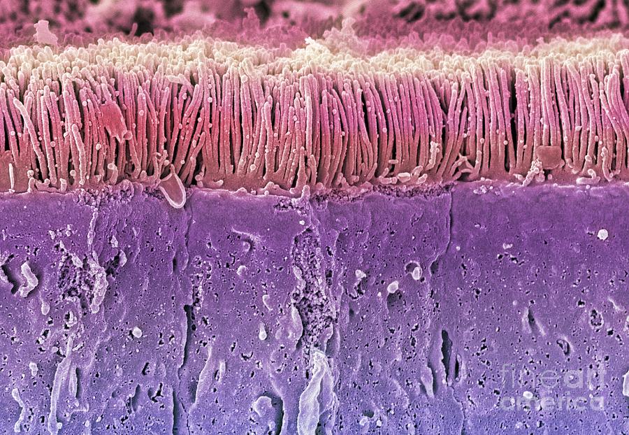 Absorption Photograph - Intestinal Microvilli, Sem #4 by Steve Gschmeissner
