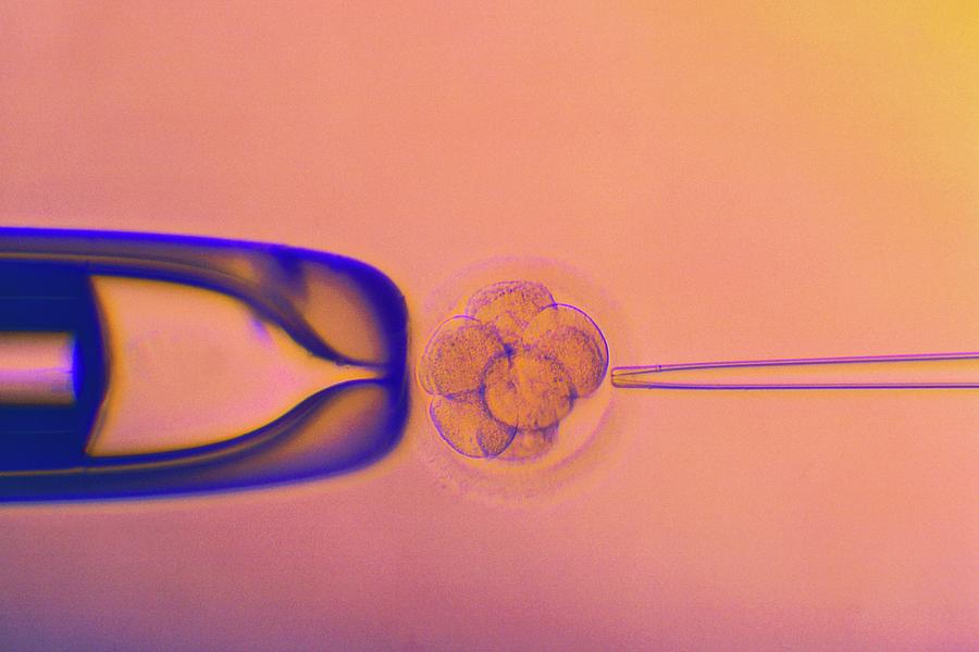 Ivf Embryo Testing #4 Photograph by Pascal Goetgheluck/science Photo Library