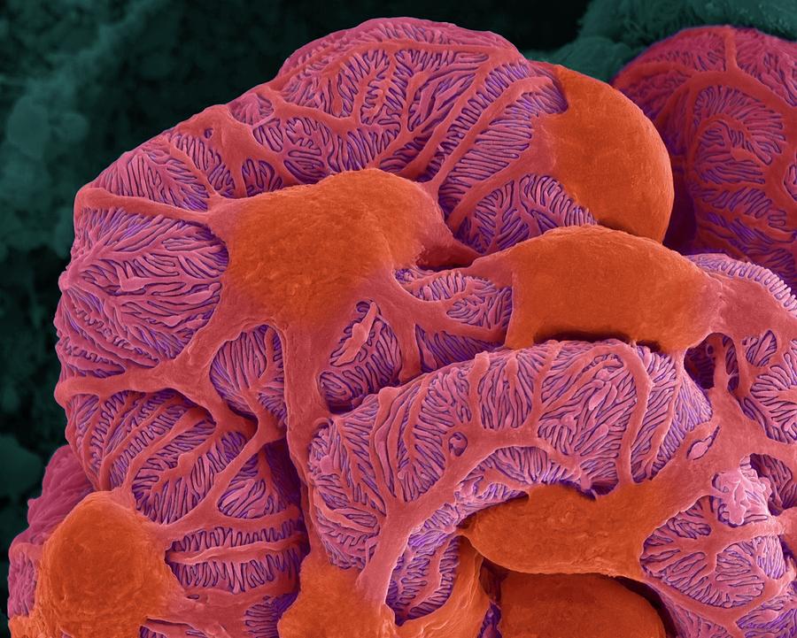 Kidney Glomerulus Photograph by Dennis Kunkel Microscopy/science Photo Library - Fine Art America