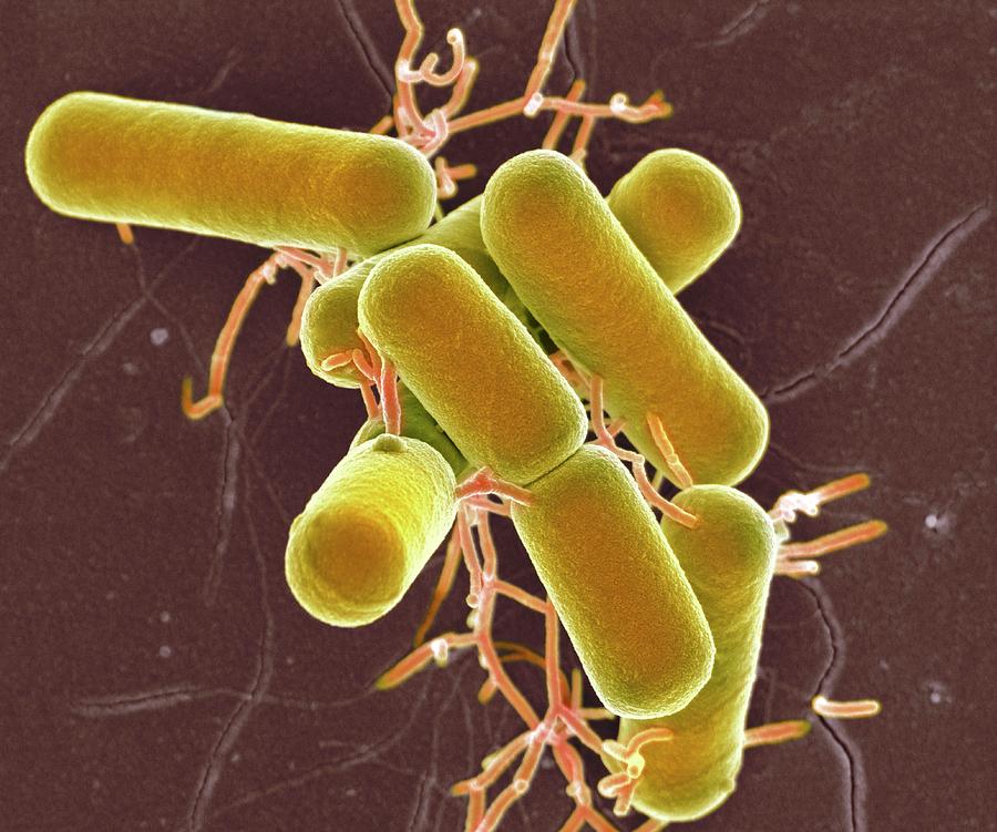 Lactobacillus Photograph - Lactobacillus Bacteria #4 by Science Photo Library