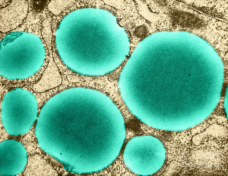 Lipid Droplets, Tem #4 Photograph by David M. Phillips