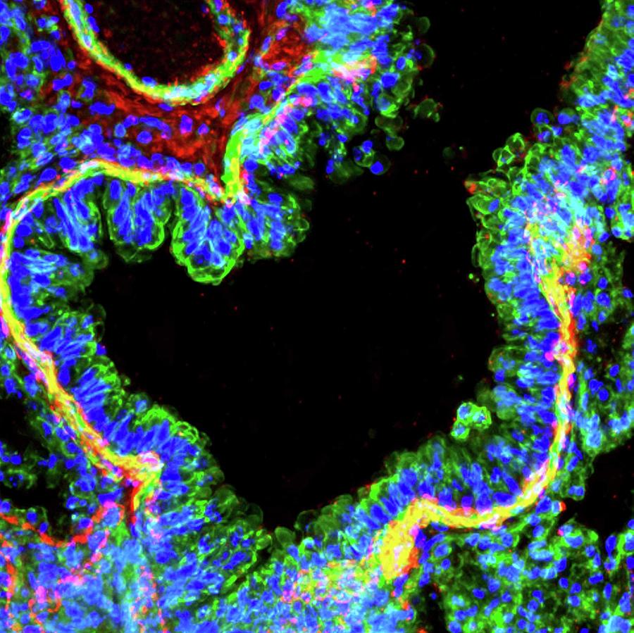 Lung Bronchiole Photograph by R. Bick, B. Poindexter, Ut Medical School ...