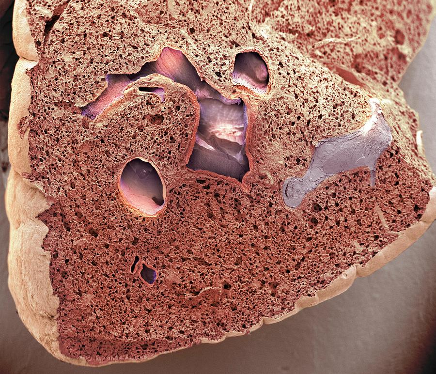 Lung Tissue #4 Photograph by Steve Gschmeissner/science Photo Library