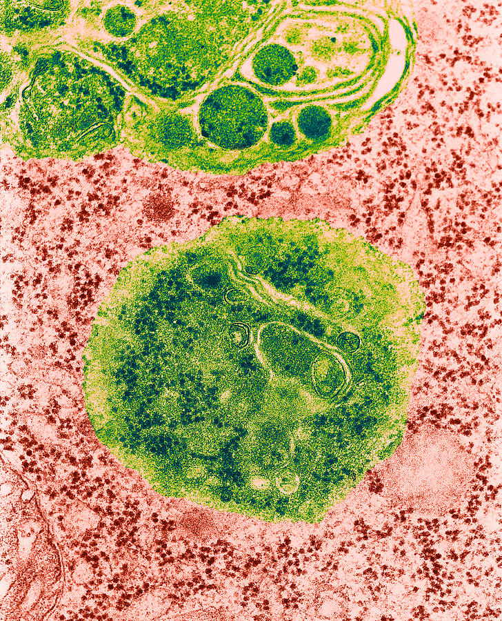 Lysosomes, Tem #4 Photograph by Science Source