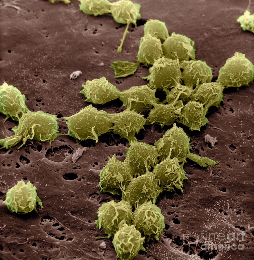 Scanning Electron Micrograph Photograph - Macrophages On The Surface #4 by David M. Phillips