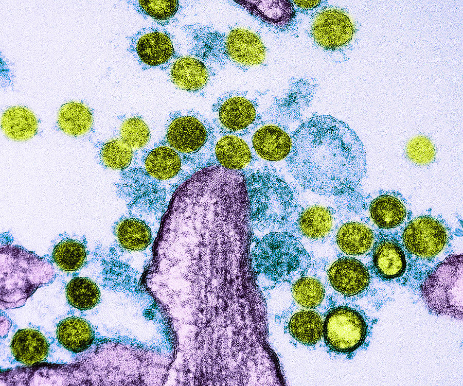 Mers Coronavirus Particles, Tem #4 Photograph by Science Source