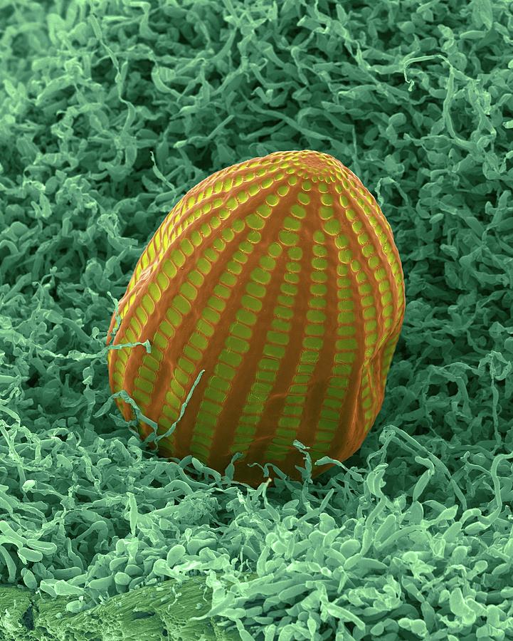 Monarch Butterfly Egg #4 Photograph by Dennis Kunkel Microscopy/science Photo Library