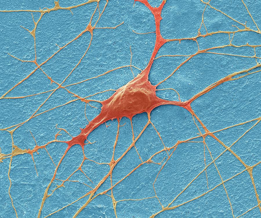 Motor Neurone #4 Photograph by Steve Gschmeissner