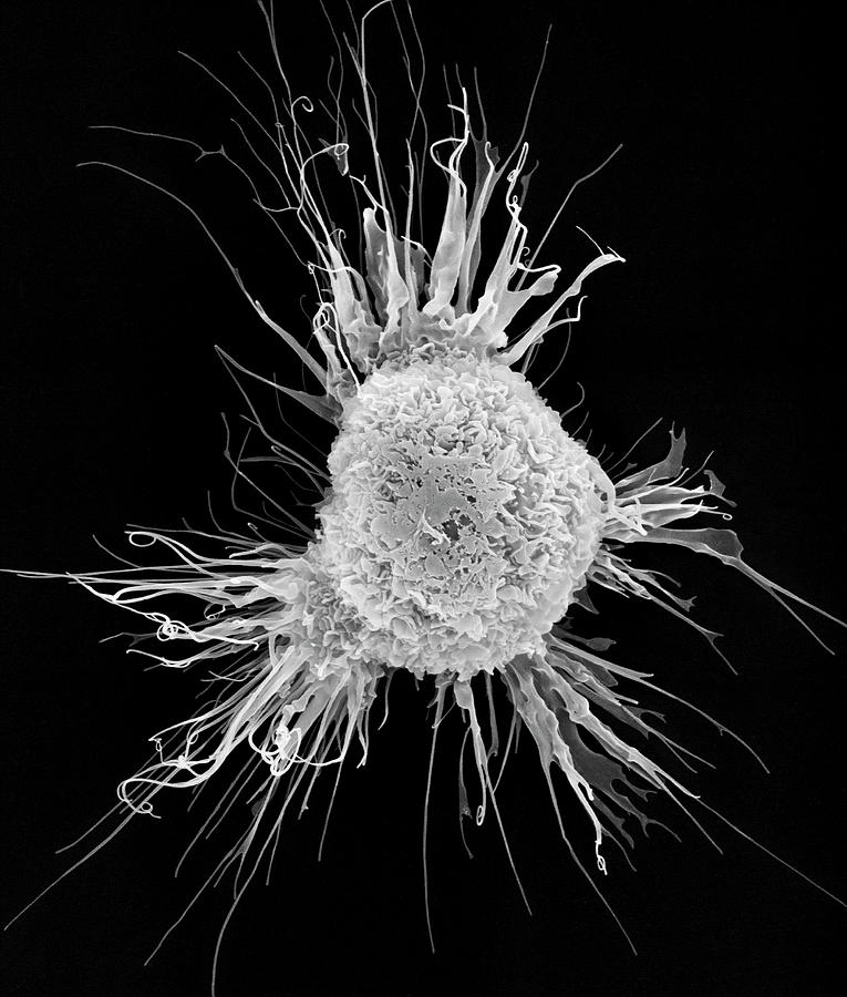 Mouse Dendritic Cell #4 Photograph by Dennis Kunkel Microscopy/science Photo Library