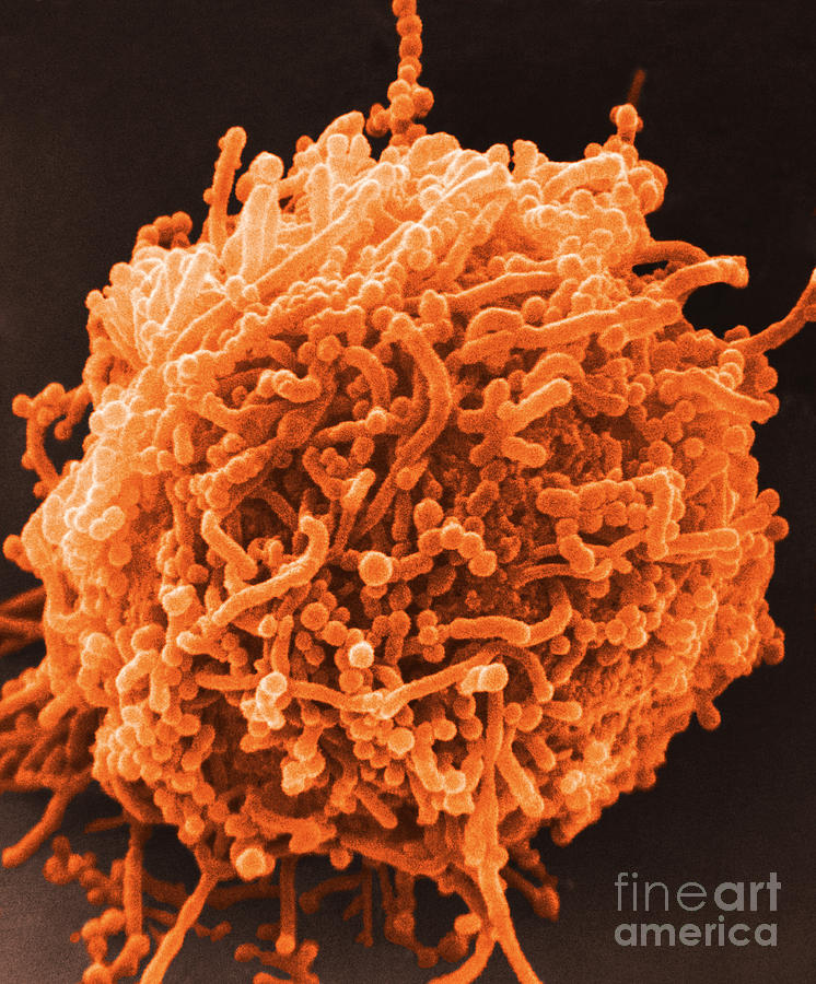SEM of Mycoplasma Bacteria Photograph by David M Phillips