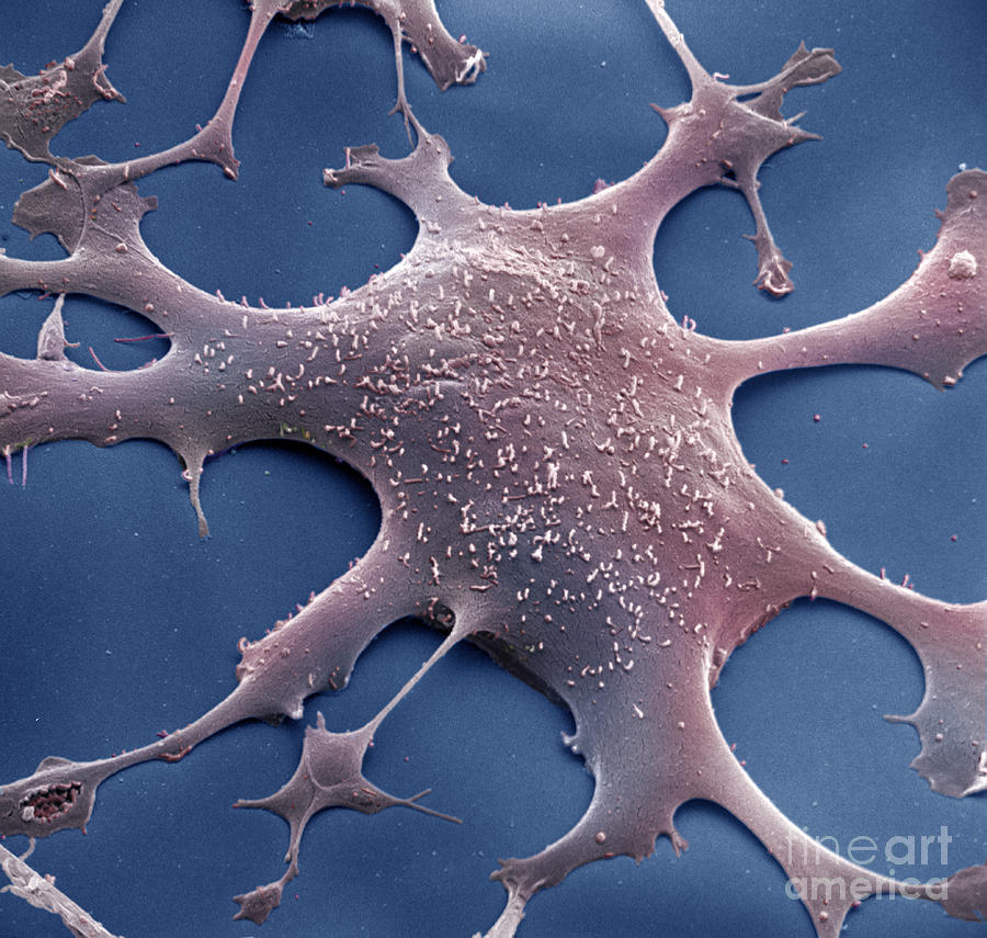 Mycoplasma #4 Photograph by David M. Phillips