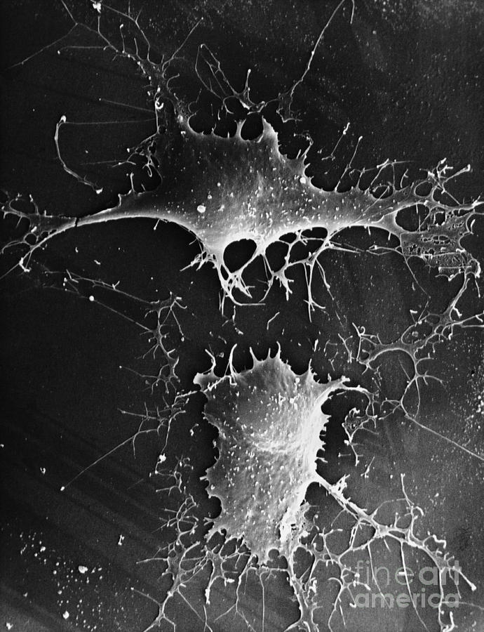 Nerve Cell Sem #4 Photograph by David M. Phillips