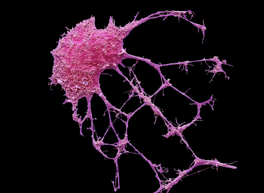 Adrenal Medulla Photograph - Neurone #4 by Steve Gschmeissner