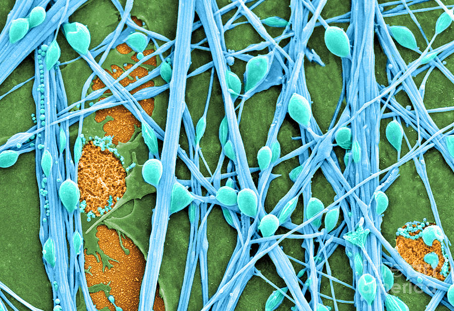 Neurons And Glial Cells, Sem #4 Photograph by Science Source