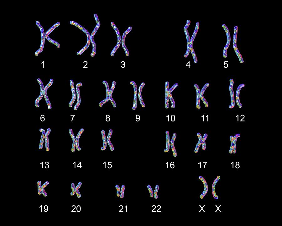 Normal Male Chromosomes Photograph By Kateryna Kon Science Photo   4 Normal Male Chromosomes Kateryna Konscience Photo Library 