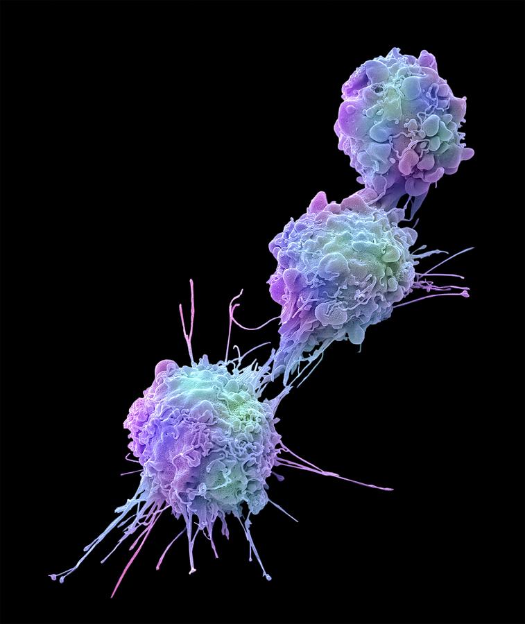Ovarian Cancer Cells #4 Photograph by Steve Gschmeissner
