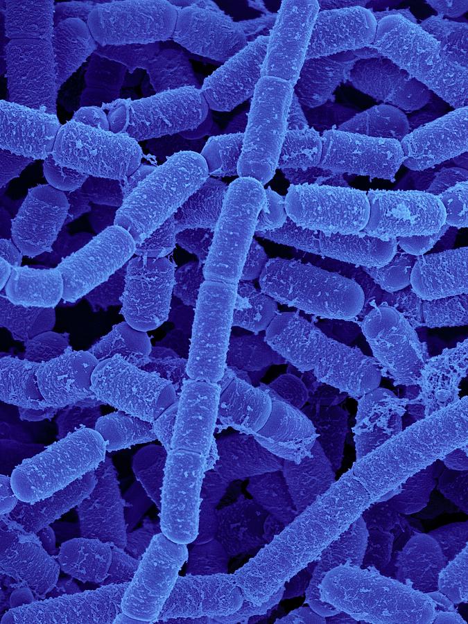 Paenibacillus Amylolyticus #4 Photograph by Dennis Kunkel Microscopy/science Photo Library