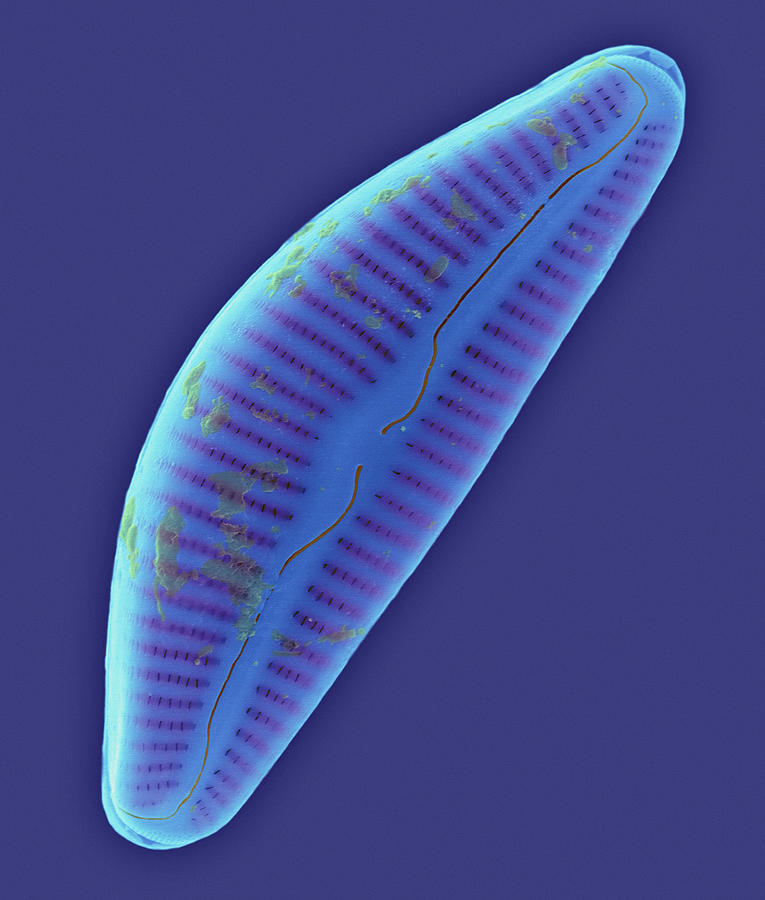 Pennate Marine Diatom (cymbella Sp.) #4 Photograph by Dennis Kunkel Microscopy/science Photo Library