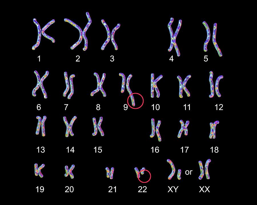 Philadelphia Chromosome #4 Photograph by Kateryna Kon/science Photo Library
