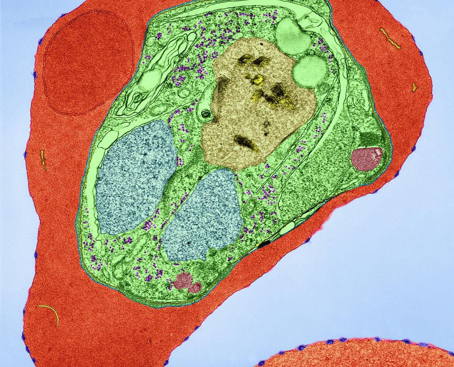 Plasmodium Falciparum #4 Photograph by Dennis Kunkel Microscopy/science Photo Library